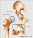 hip joint